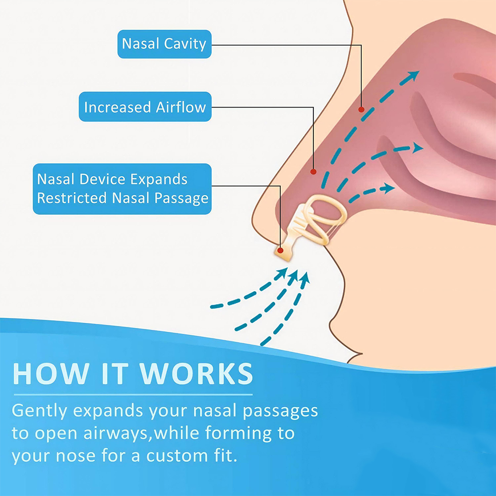 Snore Stopper Nasal Dilator fo - đánh giá và giá Anti Snore Contour Pillow