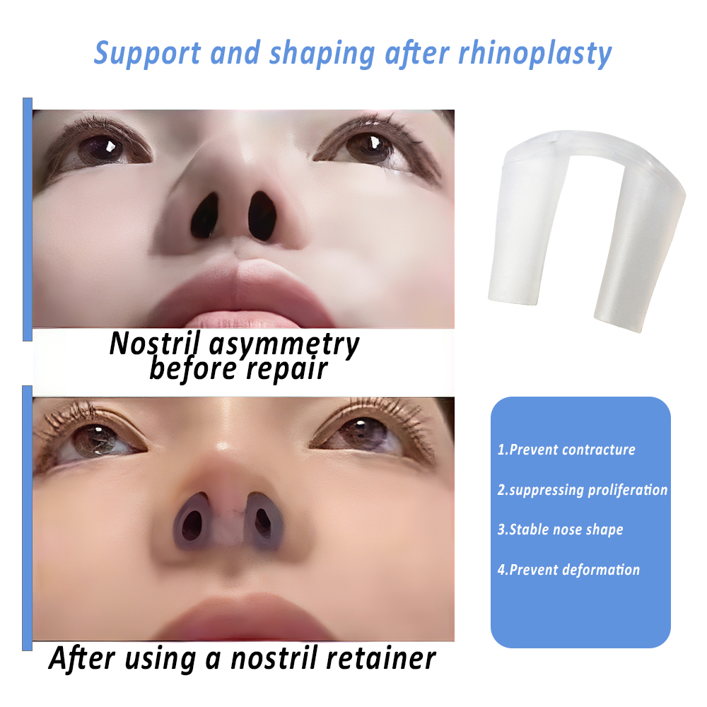 Nostril Retainer For Post-Rhin - đánh giá và giá Anti Snore Contour Pillow